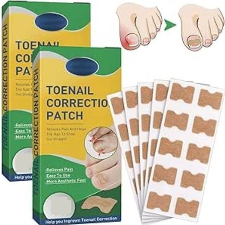 Toenail Correction Strips - 30 Pcs